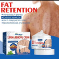 Lepoma Removal Cream (Instant Results, Guarenteed)